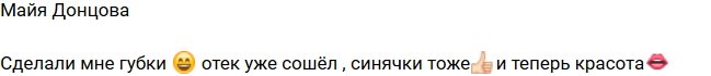 Майя Донцова увеличила губы