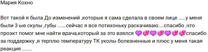 Мария Кохно: Так я выглядела до пластических операций