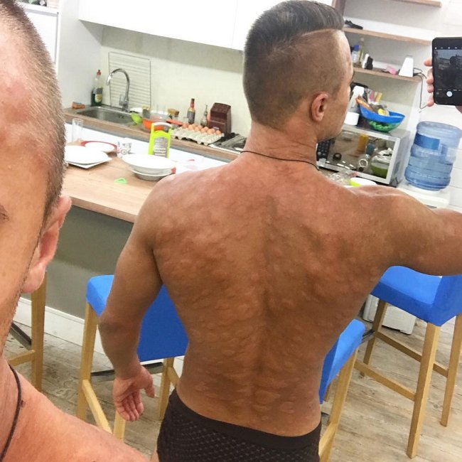 Алексей Купин попал в больницу