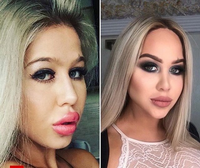 Из блога Редакции: Мария Кохно уменьшила губы