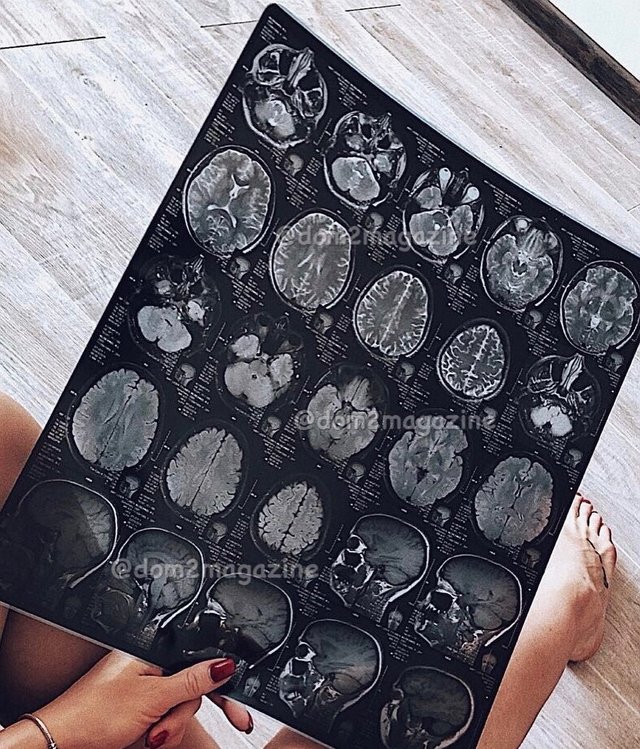 Новости журнала Дом-2 (4.03.2018)