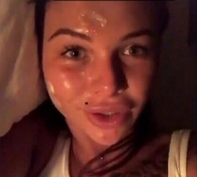 Блог редакции: У Саши Шевы «гниёт» кожа лица