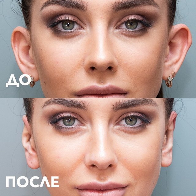 Татьяна Мусульбес: Я совсем не чувствовала боли