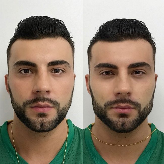 Алексей Чайчиц придал объем своим скулам