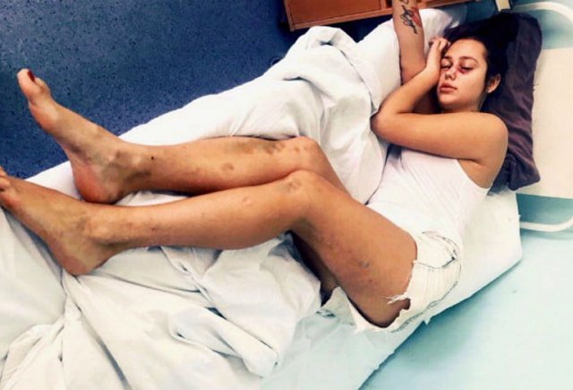 Светлану Юрченко жестоко избили на съемках реалити-шоу