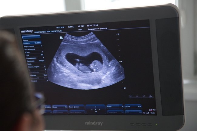 Алёна Савкина: Это непередаваемые ощущения!