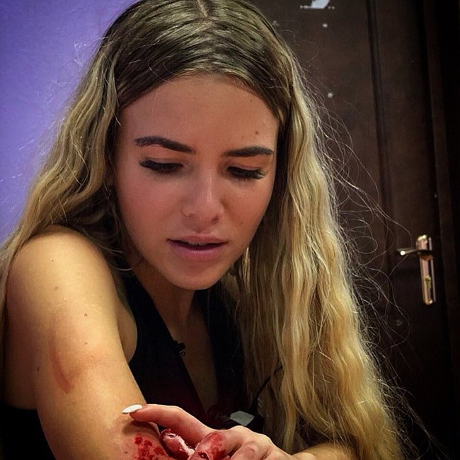 Пьяная Анастасия Ендальцева порезала Дарью Друзьяк