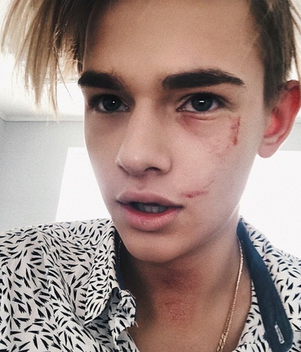 Охранник Александра Серова избил Никиту Турчина