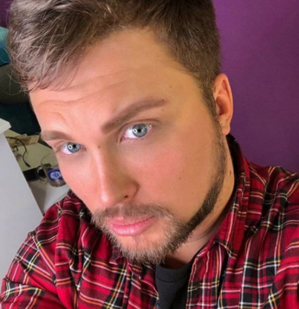 Егор Холявин оказался в реанимации после пластики лица