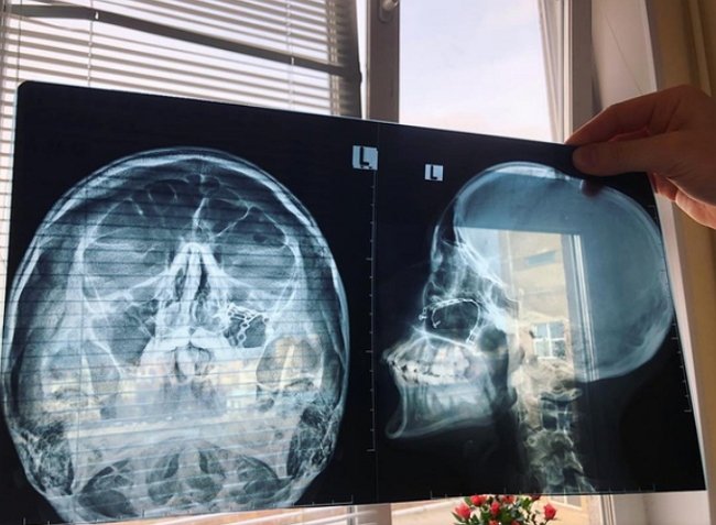 Наташа Игрунова: Я не собираюсь прощать и забывать!