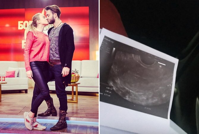 Милену Безбородову направили в женскую консультацию