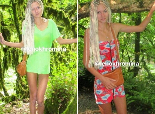 Елена Хромина призналась, что боролась с тяжёлым недугом