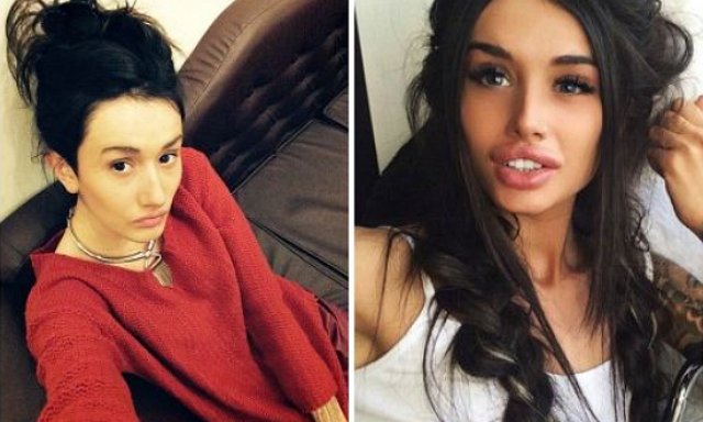 Марина Мексика снова решилась на ринопластику