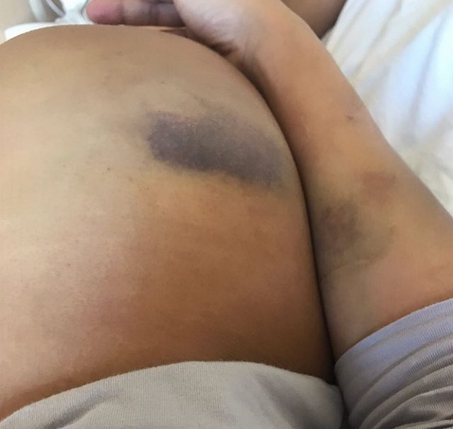 Либерж Кпадону: «Безобидный» поход в ближайший магазин