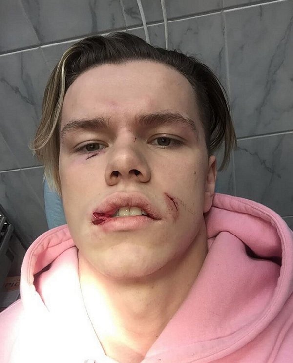 Алексей Кудряшов: Главное, что девушка не пострадала Алексей Кудряшов: Главное, что девушка не пострадала