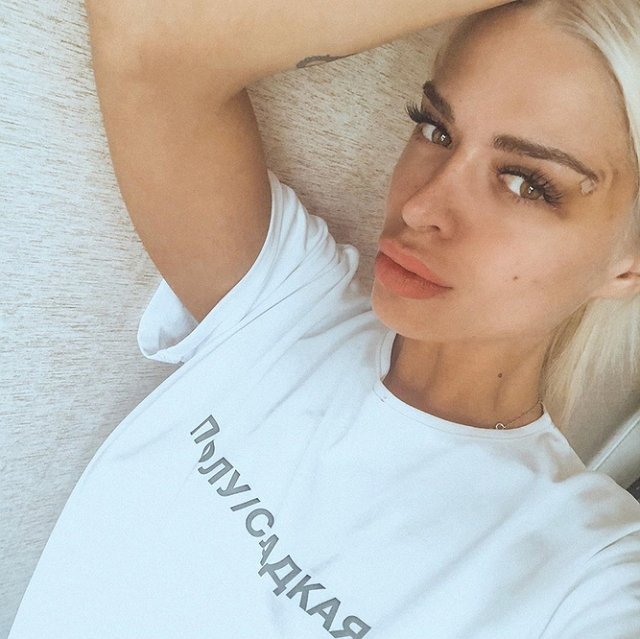 Анастасия Балинская: У меня проблемы с гормонами