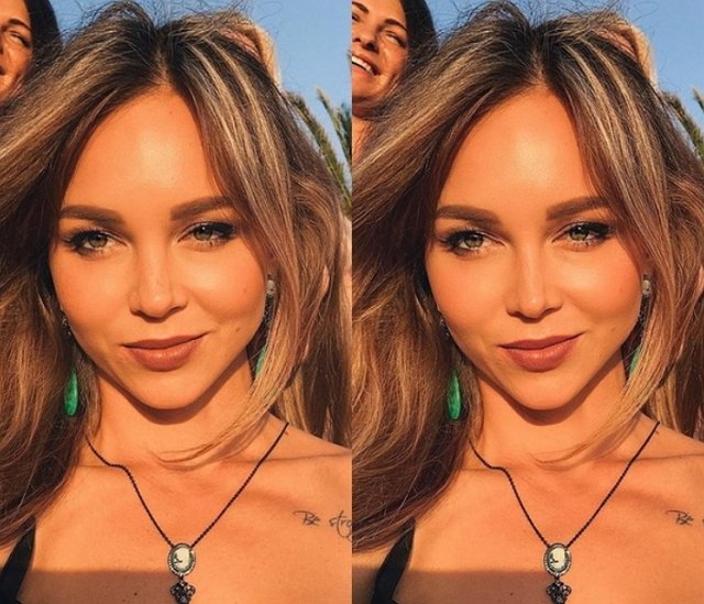 Из блога Редакции: Анастасия Лисова опять легла на хирургический стол