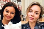 Анастасия Лисова: Всегда хотела идеальный нос