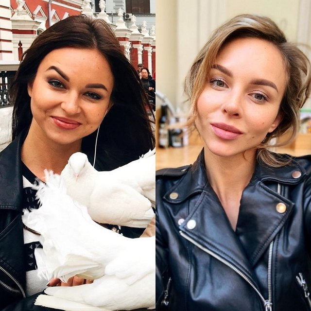 Анастасия Лисова: Всегда хотела идеальный нос