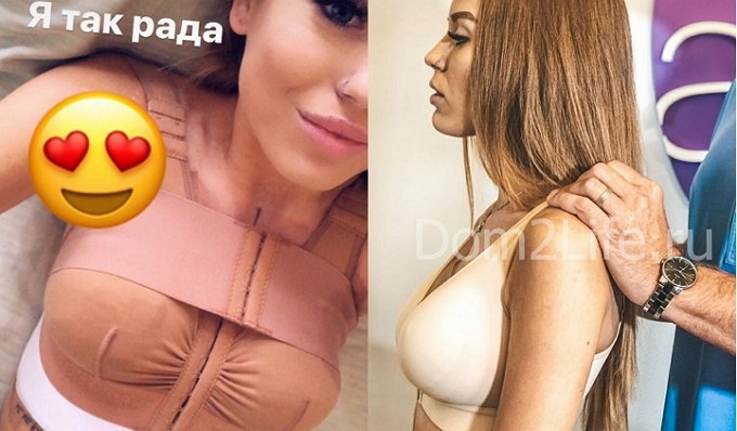 Милена Безбородова решилась на долгожданную операцию