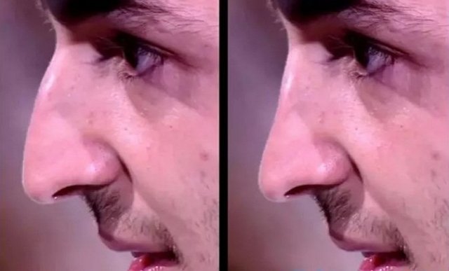 Оганесян отработал контракт с Черно и получил бесплатную ринопластику