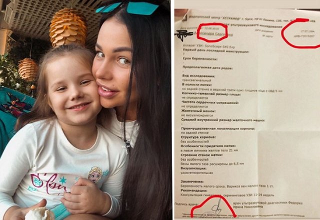 Александра Шева: Для меня беременность — это святое