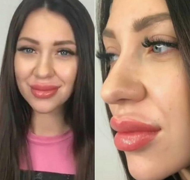 Алёна Рапунцель изуродовала собственную внешность Алёна Рапунцель изуродовала собственную внешность