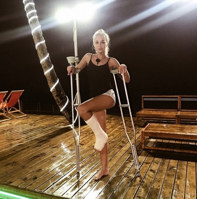 У Анастасии Стецевят перелом ноги