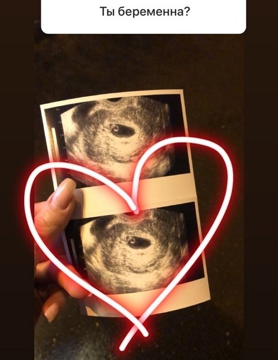 Настя Коткова боится за своего неродившегося ребёнка