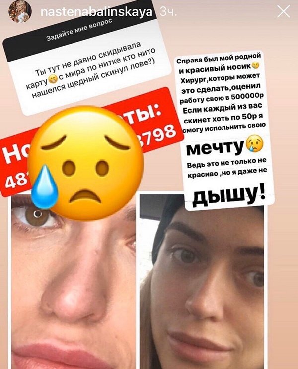 Настя Балинская нуждается в деньгах на новую ринопластику