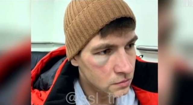 Дмитренко получил фингал от супруги, а не от Шабарина