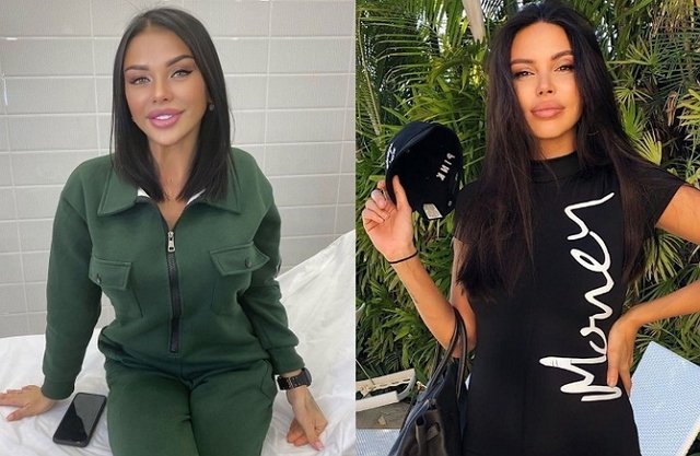 Саша Шева снова перекроила лицо и стала копией жены Джигана