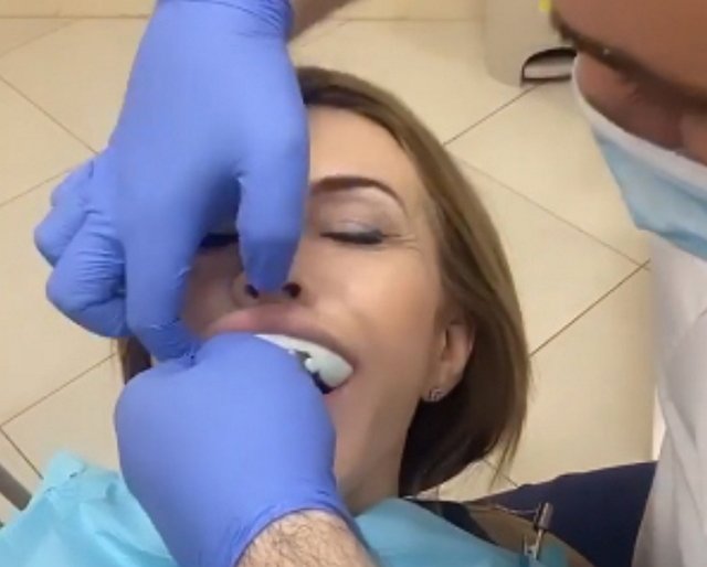 Ирина Агибалова решила поставить виниры