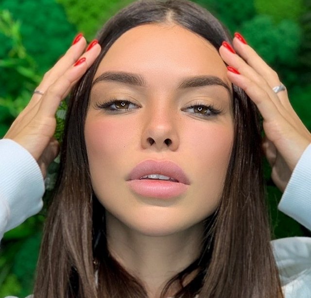 Косметолог отказалась увеличивать губы Алине Галимовой