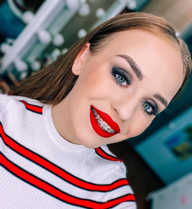 Милена Безбородова: Мечтаю об улыбке в 32 зуба