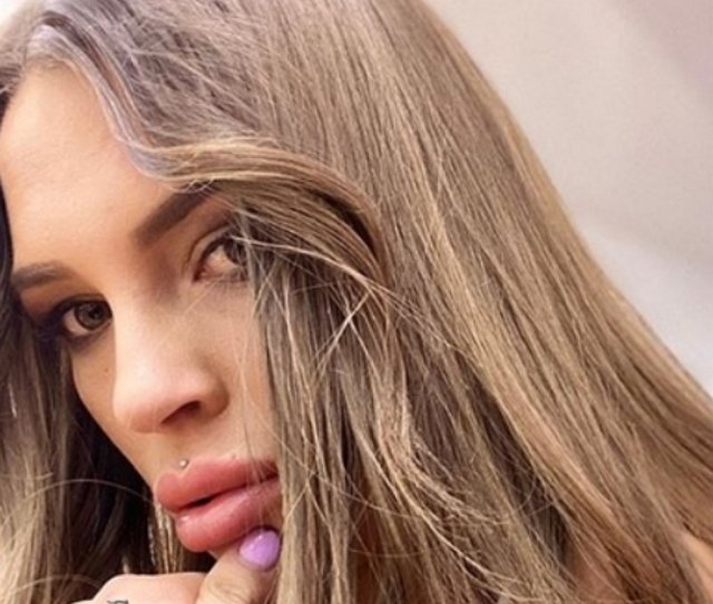 Виктория Каплий: Перелома нет, но был ушиб копчика