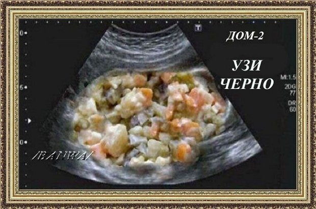 Приколы о Дом-2 (7.05.2020)