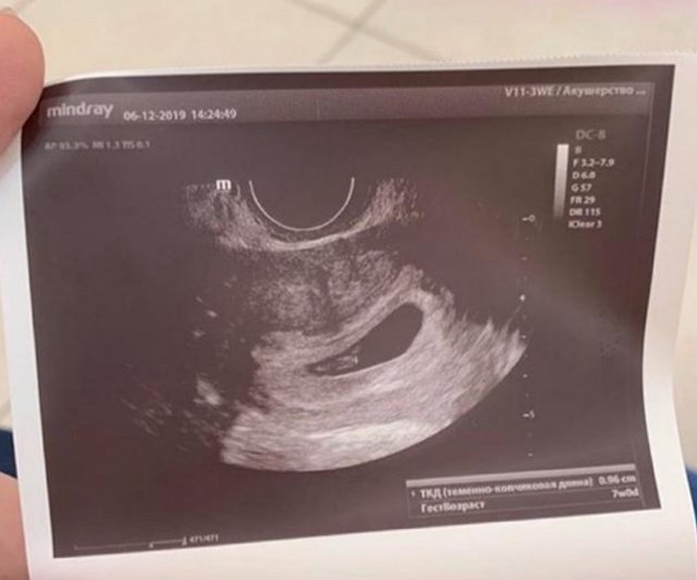 Новости журнала Дом-2 (10.05.2020)