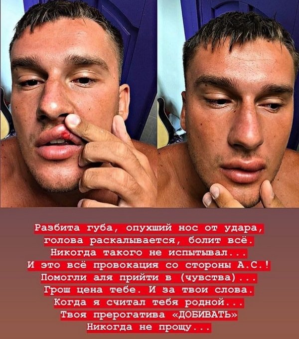 Никита Барышев нанес Насте Стецевят увечья