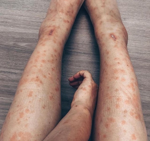 Нелли Ермолаева: Мне это было дико нужно!