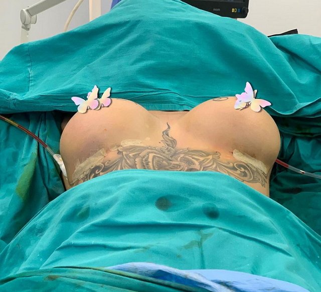 Марина Мексика сделала новую грудь