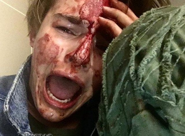 Никита Турчин: Мне нанесли множественные травмы