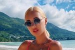 Анастасия Стецевят: Опять медленно хожу и хромаю
