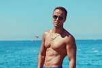 Никита Уманский: Будут пересаживать волосы