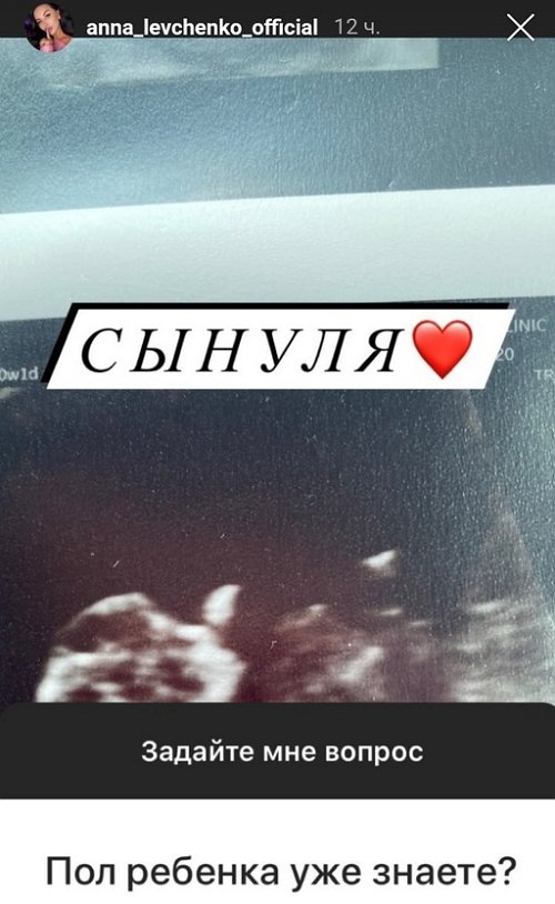 Анна Левченко: Я была не в том состоянии