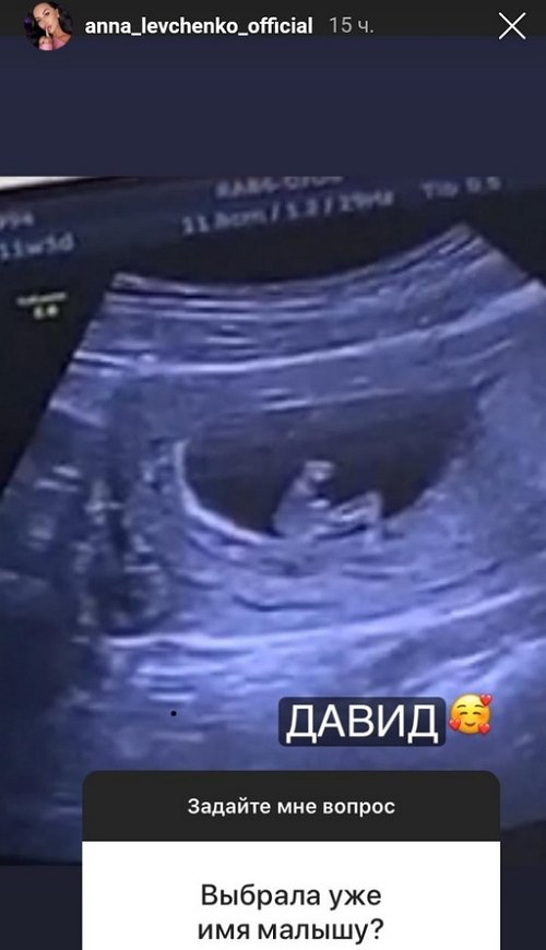 Анна Левченко: Я была не в том состоянии