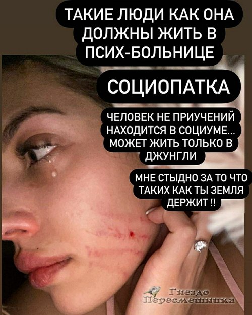 Анна Мадан: Её место в психбольнице