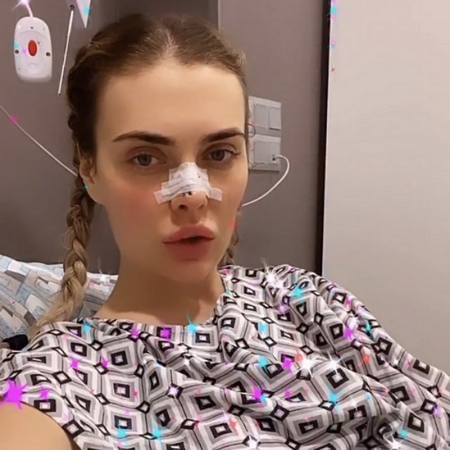 Юлия Жукова: Нос немного болит, но это все временно Юлия Жукова: Нос немного болит, но это все временно