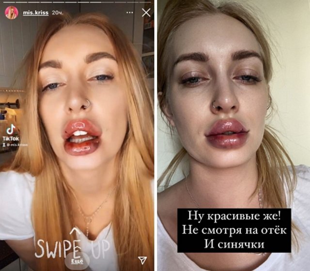 Кристина Дерябина перестала выходить из дома