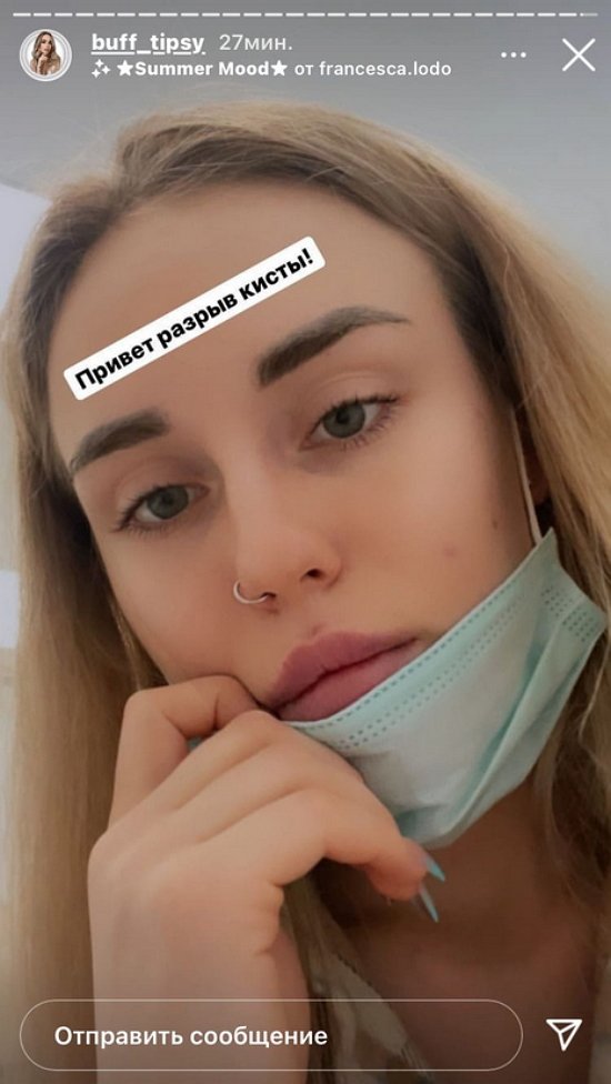 Милена Безбородова: Очень плохое самочувствие